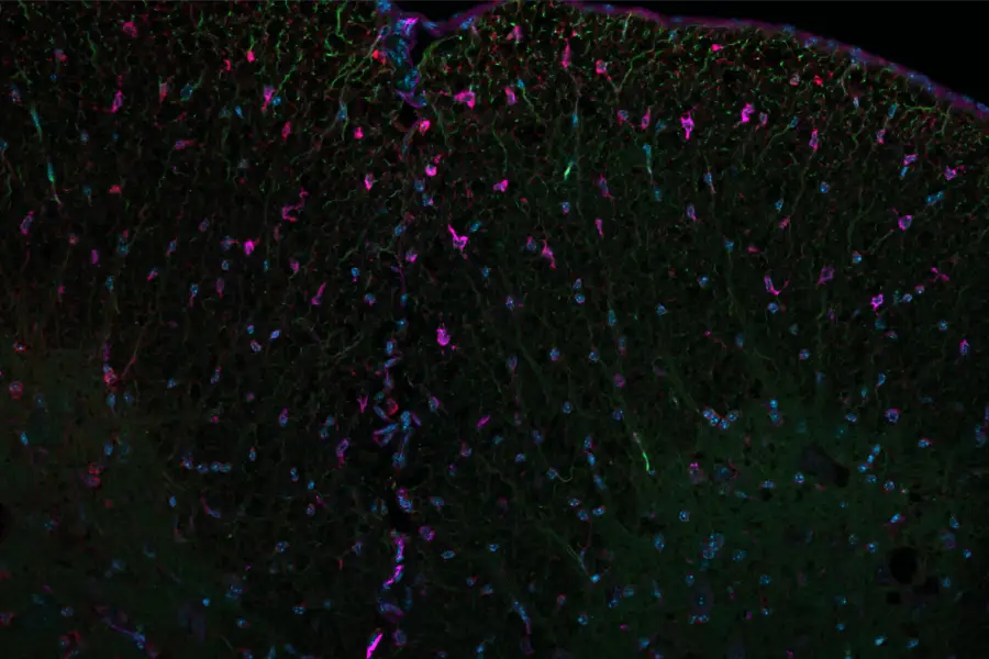 Alerie Guzmán - Research focus myelin regeneration